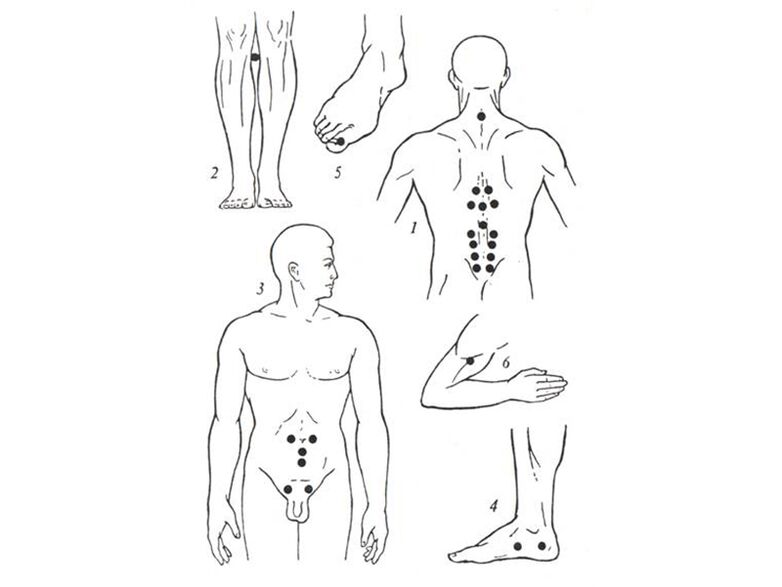 Masaje de acupuntura